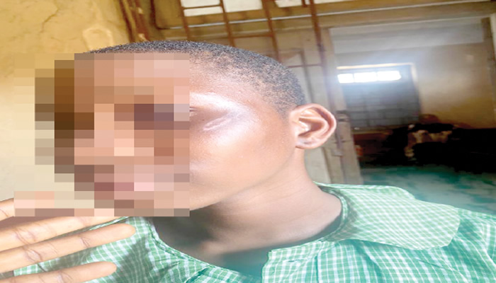 Guardians tackle government school, charge attack on 14-year-old girl
