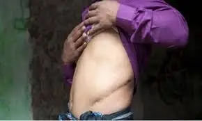 Exploitation and Deception: The Tragic Reality of Kidney Trafficking in Nepal